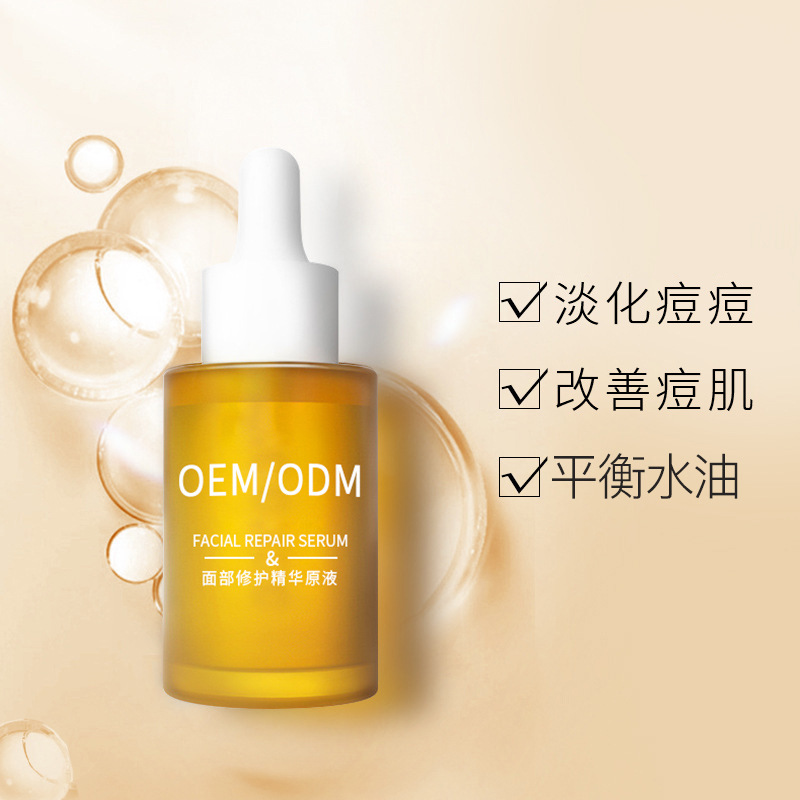 安庆市_祛痘精华原液OEM